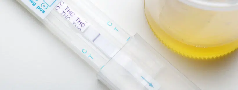 Drug Test, Weed, Marijuana, Blood Test